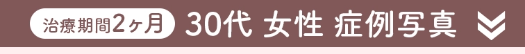 01:30代女性治療事例