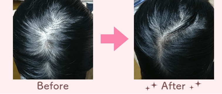 開始月・2ヶ月後